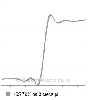 Средняя стоимость МРТ средостения в Челябинске