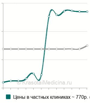 Средняя стоимость УЗИ селезенки в Челябинске