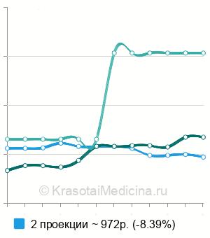 Средняя стоимость рентген стопы в Челябинске