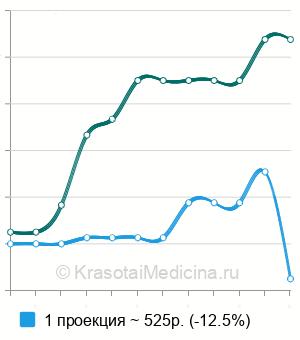 Средняя стоимость рентген предплечья в Челябинске
