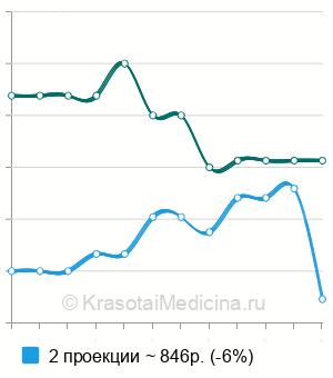 Средняя стоимость рентген кисти в Челябинске