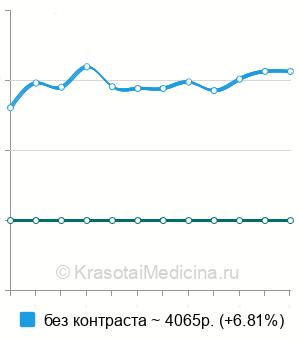 Средняя стоимость КТ височных костей в Челябинске