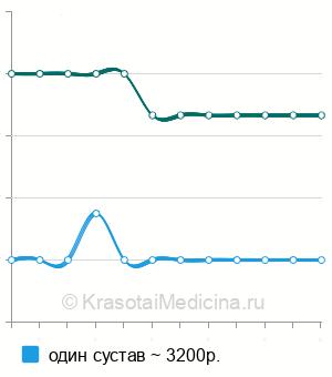 Средняя стоимость КТ височно-нижнечелюстных суставов в Челябинске