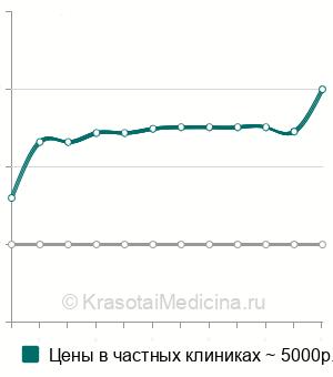 Средняя стоимость МРТ кисти в Челябинске