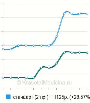 Средняя стоимость рентген грудины в Челябинске